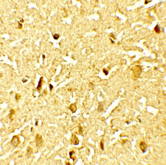 Phospho-SAMHD1 (Thr592) Antibody in Immunohistochemistry (Paraffin) (IHC (P))