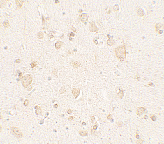 ULK4 Antibody in Immunohistochemistry (Paraffin) (IHC (P))
