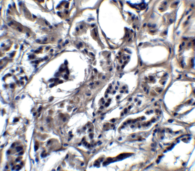 BATF3 Antibody in Immunohistochemistry (IHC)