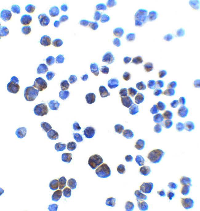 AJAP1 Antibody in Immunocytochemistry (ICC/IF)