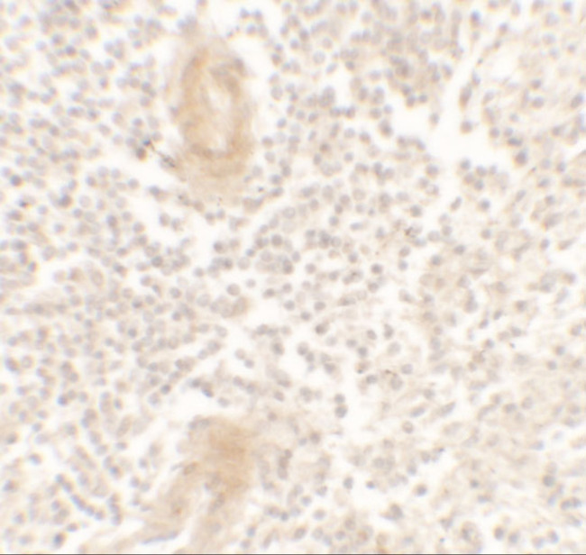 IL1F10 Antibody in Immunohistochemistry (Paraffin) (IHC (P))