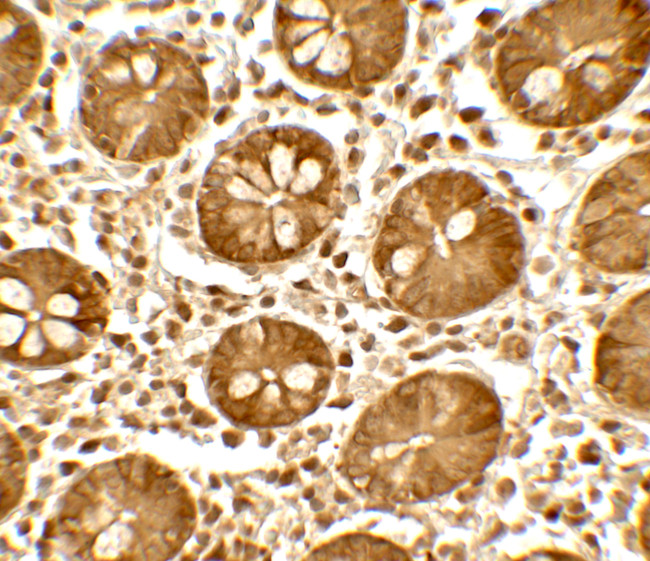 Treslin Antibody in Immunohistochemistry (Paraffin) (IHC (P))
