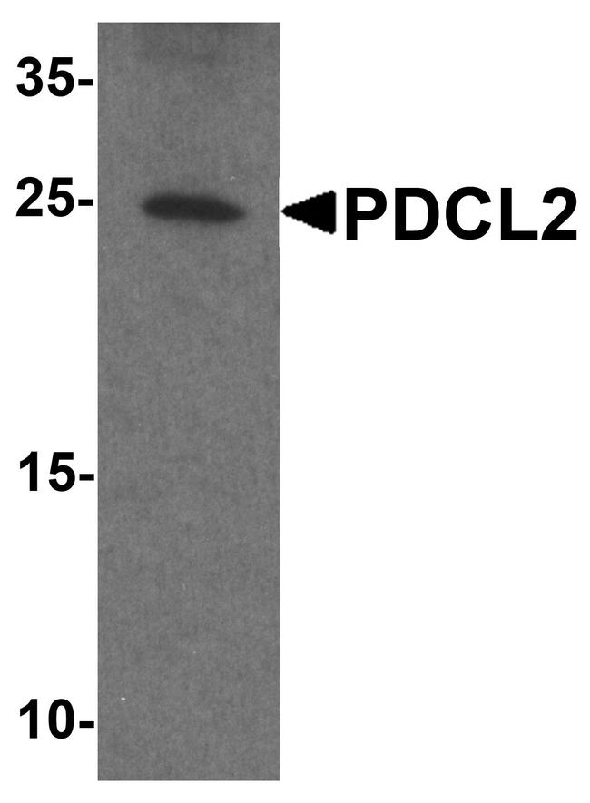 PDCL2 Antibody in Western Blot (WB)