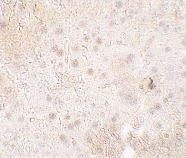 TMIGD1 Antibody in Immunohistochemistry (Paraffin) (IHC (P))