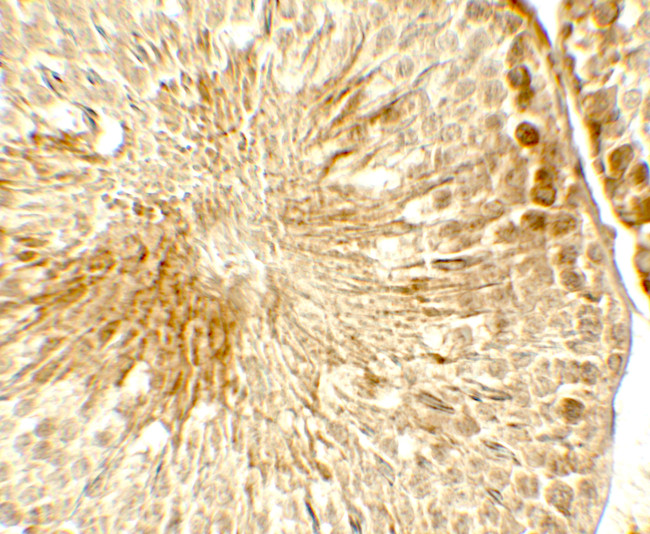 TOPAZ1 Antibody in Immunohistochemistry (Paraffin) (IHC (P))