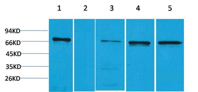 ZBTB45 Antibody in Western Blot (WB)