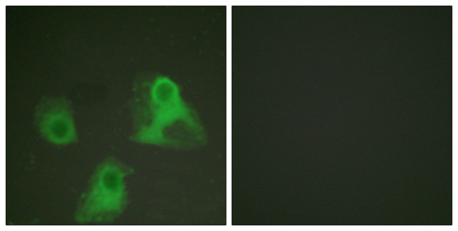 Phospho-alpha Adducin (Ser726) Antibody in Immunocytochemistry (ICC/IF)