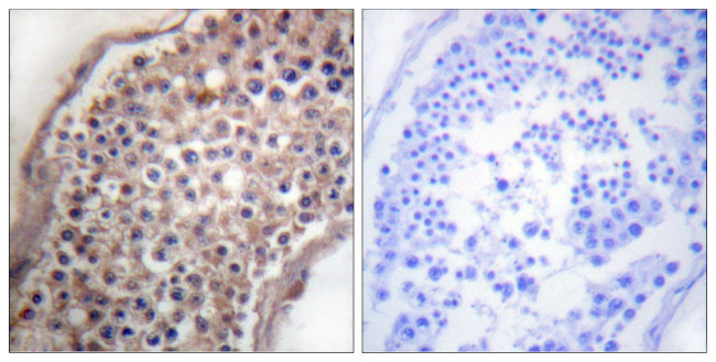 Ephrin B1/B3 Antibody in Immunohistochemistry (Paraffin) (IHC (P))