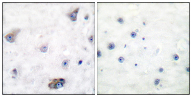 Phospho-GABRB1 (Ser434) Antibody in Immunohistochemistry (Paraffin) (IHC (P))