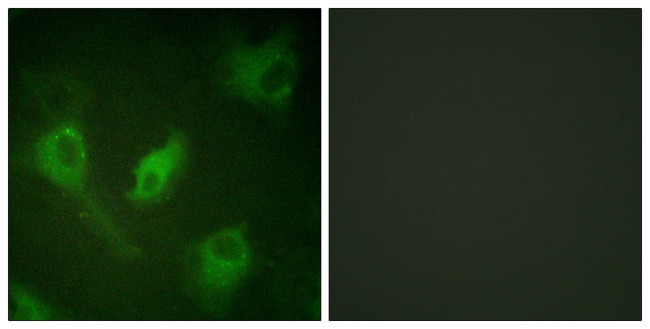 IkB epsilon Antibody in Immunocytochemistry (ICC/IF)