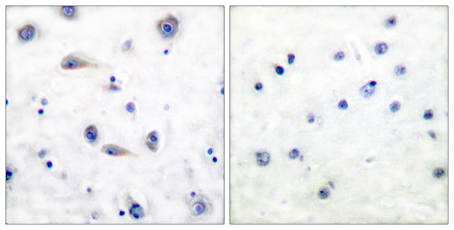 Phospho-TrkB (Tyr515) Antibody in Immunohistochemistry (Paraffin) (IHC (P))