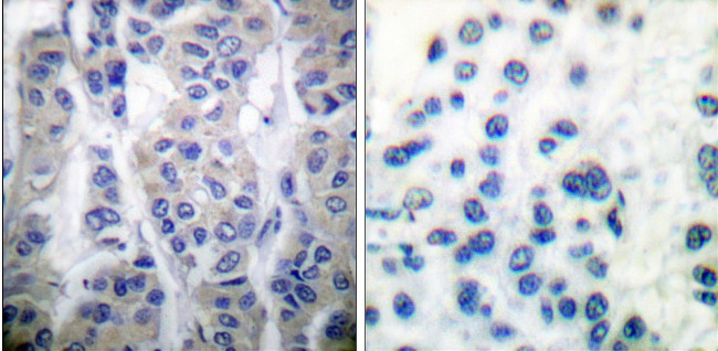 Phospho-LIMK1/LIMK2 (Thr508, Thr505) Antibody in Immunohistochemistry (Paraffin) (IHC (P))