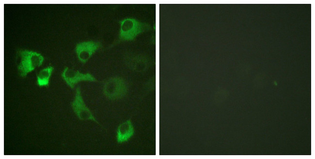 Phospho-EEF2 (Thr56) Antibody in Immunocytochemistry (ICC/IF)