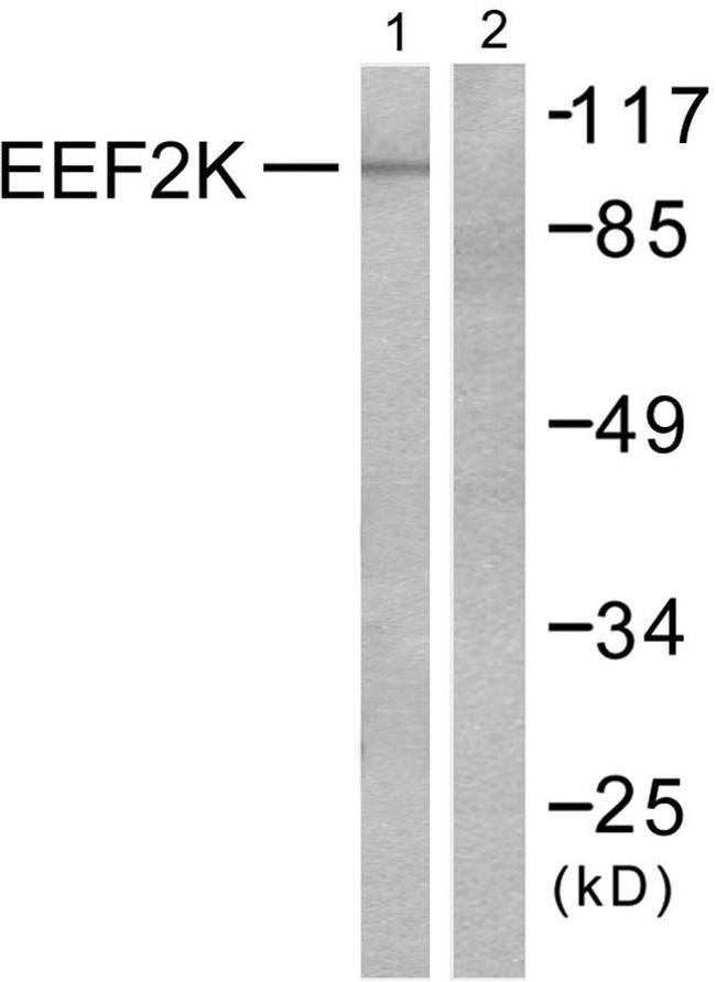 EEF2K Antibody in Western Blot (WB)
