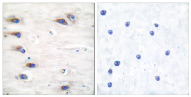 Phospho-KSR1 (Ser392) Antibody in Immunohistochemistry (Paraffin) (IHC (P))