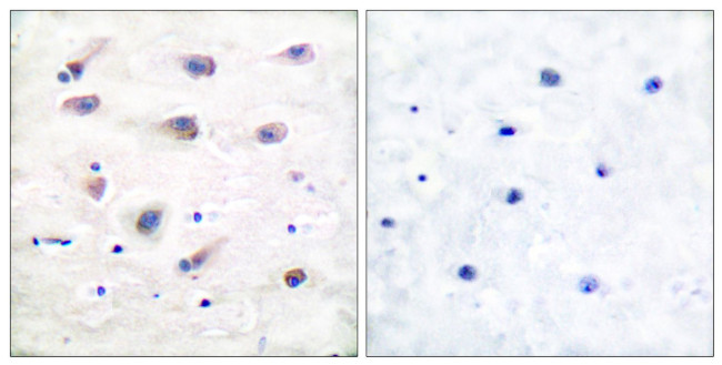 Phospho-PLCB3 (Ser1105) Antibody in Immunohistochemistry (Paraffin) (IHC (P))