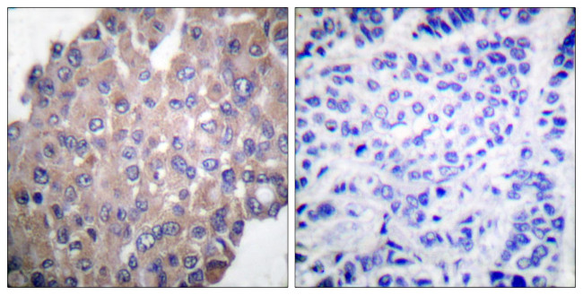 Phospho-PLCG1 (Tyr771) Antibody in Immunohistochemistry (Paraffin) (IHC (P))