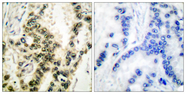 Phospho-SRF (Ser99) Antibody in Immunohistochemistry (Paraffin) (IHC (P))