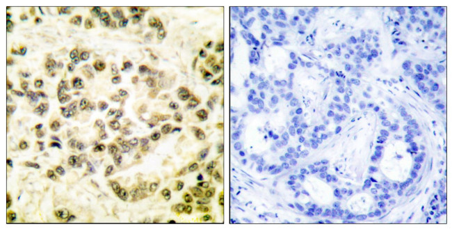 Phospho-STAT5 beta (Ser731) Antibody in Immunohistochemistry (Paraffin) (IHC (P))