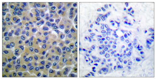 Phospho-Syk (Tyr348) Antibody in Immunohistochemistry (Paraffin) (IHC (P))
