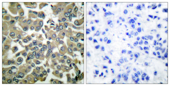 Phospho-WNK1 (Thr58) Antibody in Immunohistochemistry (Paraffin) (IHC (P))