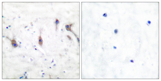 ARC Antibody in Immunohistochemistry (Paraffin) (IHC (P))
