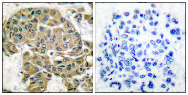 Mammaglobin B Antibody in Immunohistochemistry (Paraffin) (IHC (P))
