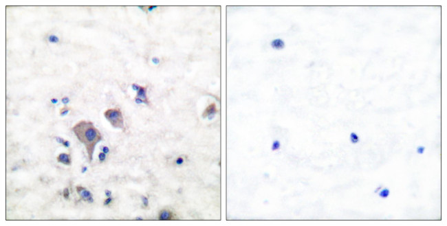 GluR2/GluR3 Antibody in Immunohistochemistry (Paraffin) (IHC (P))