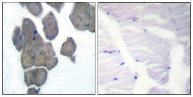 Phospho-Acetyl-CoA Carboxylase (Ser80) Antibody in Immunohistochemistry (Paraffin) (IHC (P))