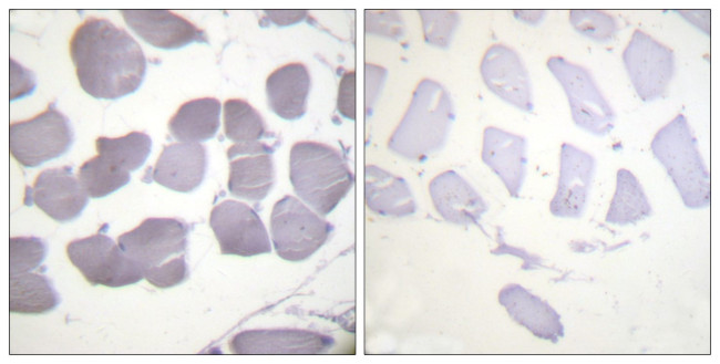 Phospho-AMPK beta-1 (Ser181) Antibody in Immunohistochemistry (Paraffin) (IHC (P))