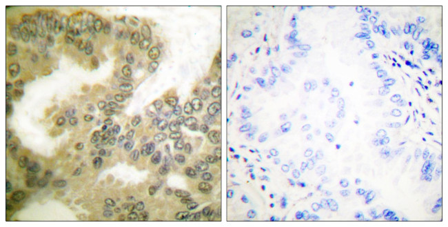 Phospho-Cyclin D3 (Thr283) Antibody in Immunohistochemistry (Paraffin) (IHC (P))