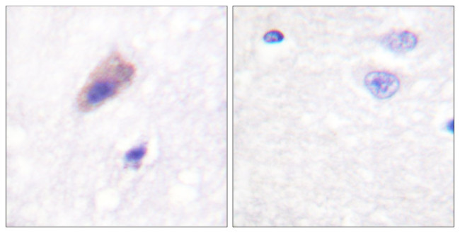 Phospho-Dynamin 1 (Ser774) Antibody in Immunohistochemistry (Paraffin) (IHC (P))