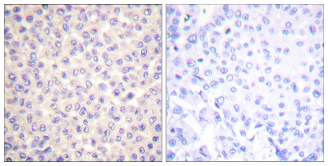 Phospho-FADD (Ser194) Antibody in Immunohistochemistry (Paraffin) (IHC (P))