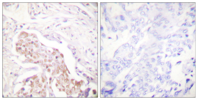 Phospho-FANCD2 (Ser222) Antibody in Immunohistochemistry (Paraffin) (IHC (P))
