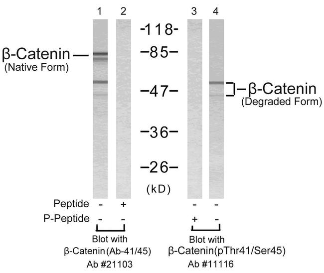 Phospho-beta Catenin (Thr41, Ser45) Antibody in Western Blot (WB)