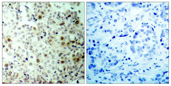 Phospho-CDK2 (Thr160) Antibody in Immunohistochemistry (Paraffin) (IHC (P))