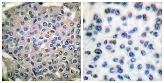Phospho-Cortactin (Tyr466) Antibody in Immunohistochemistry (Paraffin) (IHC (P))