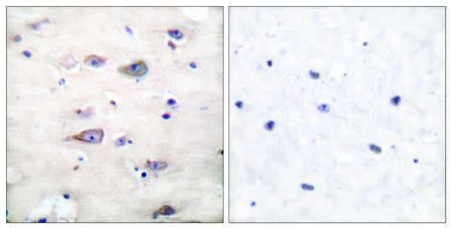 Phospho-GluR2 (Ser880) Antibody in Immunohistochemistry (Paraffin) (IHC (P))