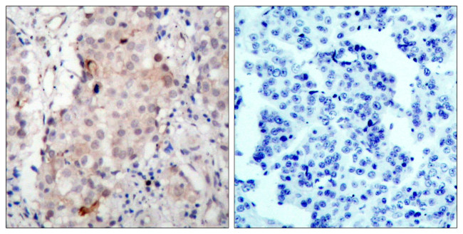 Phospho-ErbB2 (HER-2) (Tyr1221, Tyr1222) Antibody in Immunohistochemistry (Paraffin) (IHC (P))