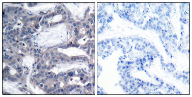 Phospho-MEK2 (Thr394) Antibody in Immunohistochemistry (Paraffin) (IHC (P))