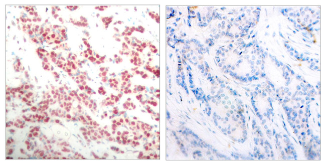 Phospho-NFkB p52 (Ser865) Antibody in Immunohistochemistry (Paraffin) (IHC (P))