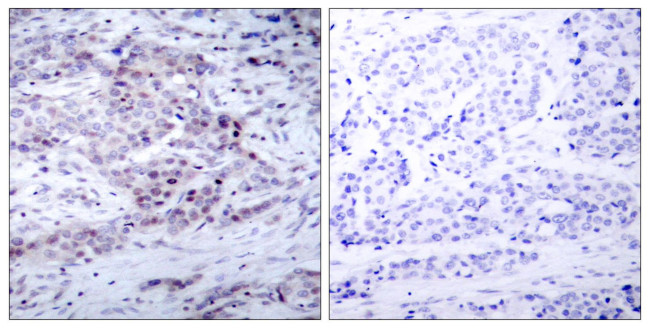 Phospho-NFkB p52 (Ser869) Antibody in Immunohistochemistry (Paraffin) (IHC (P))