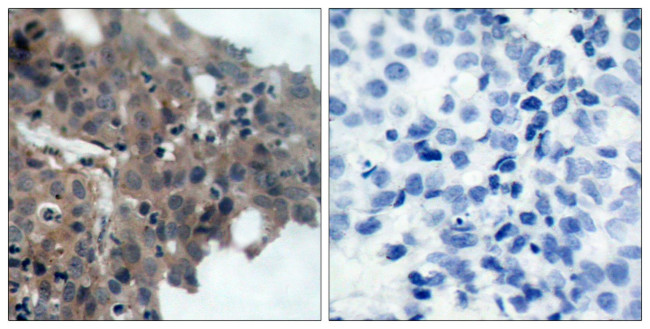 Phospho-p21 (Thr145) Antibody in Immunohistochemistry (Paraffin) (IHC (P))