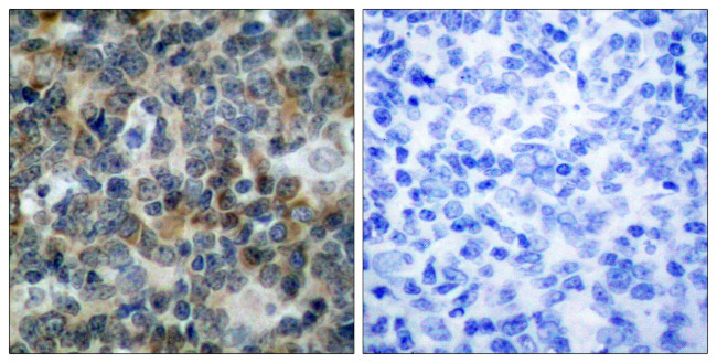 Phospho-VASP (Ser238) Antibody in Immunohistochemistry (Paraffin) (IHC (P))