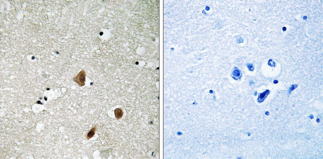 Phospho-PAK3 (Ser154) Antibody in Immunohistochemistry (Paraffin) (IHC (P))