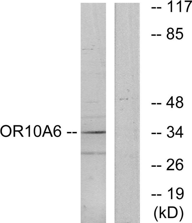 OR10A6 Antibody in Western Blot (WB)