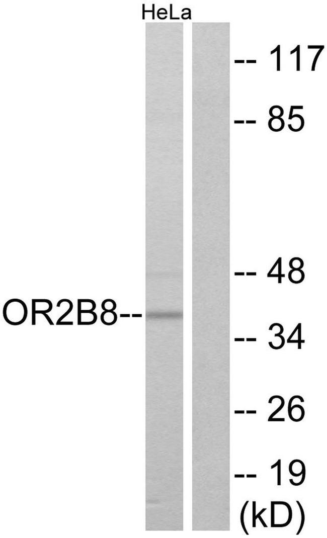 OR2B8P Antibody in Western Blot (WB)