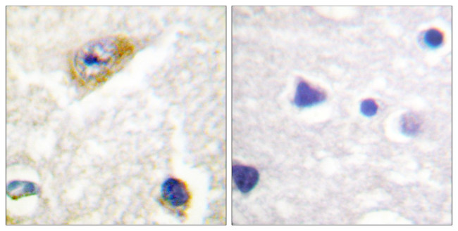 Phospho-CaMKII alpha/beta/delta (Thr305) Antibody in Immunohistochemistry (Paraffin) (IHC (P))