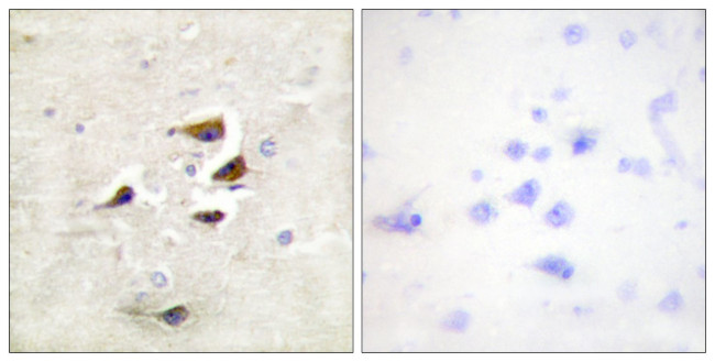 CaMKII alpha/beta/delta Antibody in Immunohistochemistry (Paraffin) (IHC (P))
