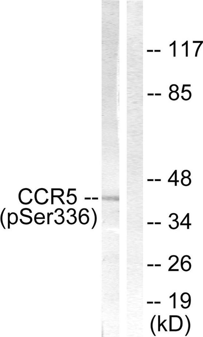 Phospho-CCR5 (Ser336) Antibody in Western Blot (WB)